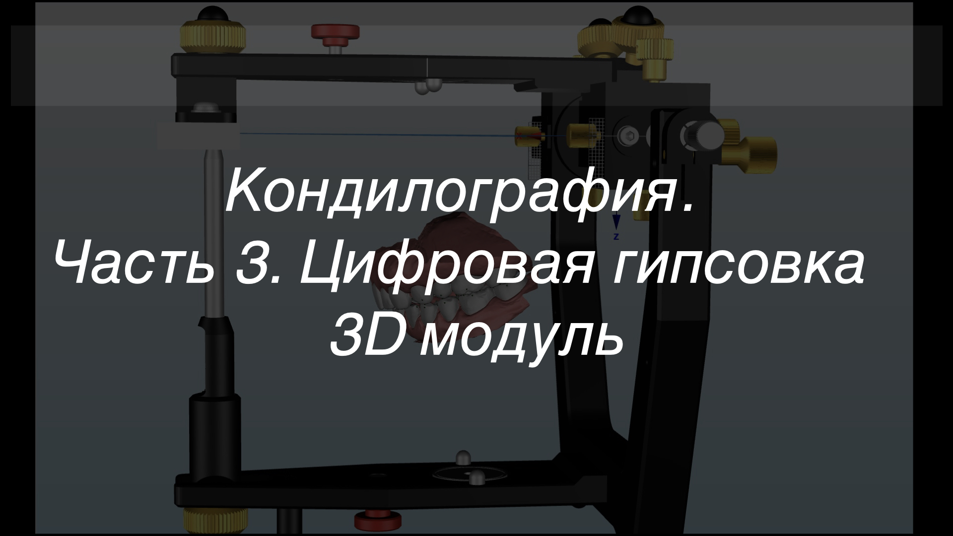 Кондилография. Часть 3. Цифровая гипсовка и 3D модуль